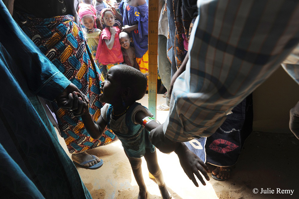 니제르 국경없는의사회 팀이 아이의 영양상태 신속하게 진단하고 있다.
