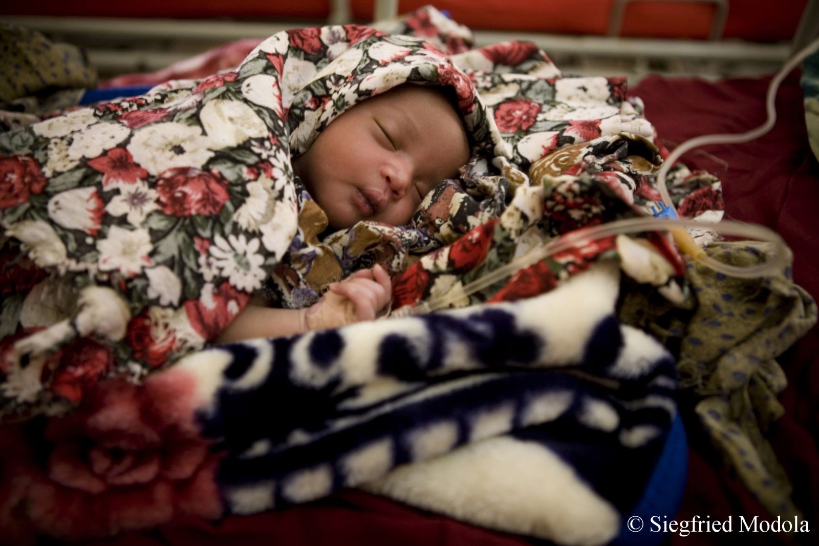 아기가 국경없는의사회 북 갈카요 산후조리 병동에서 쉬고 있다.   