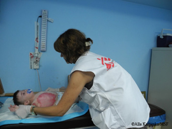 자발 모셴 진료소에서 화상을 입은 아동을 치료하고 있다. ©Alla Karpenko/ MSF