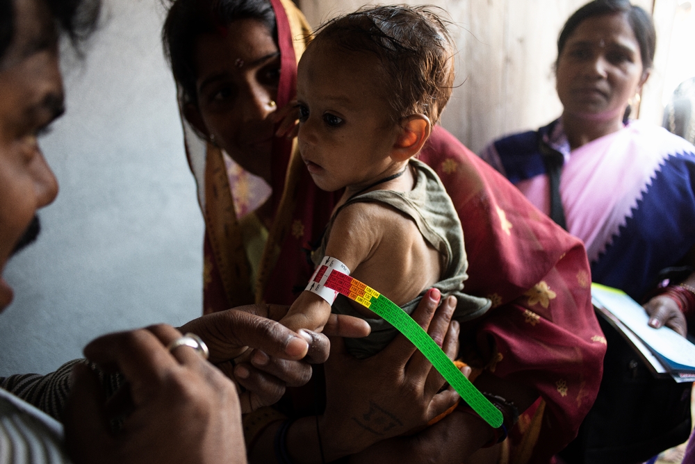 국경없는의사회는 2009년부터 인도 비하르지역에서 영양실조 아동들을 치료해왔다. ©Sami Siva