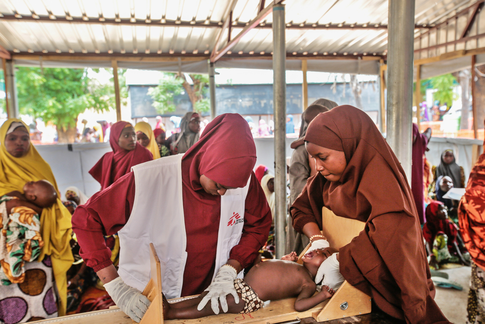 국경없는의사회 직원이 외래환자 급식 센터에서 아동 환자를 검진하고 있다. ©George Osodi  