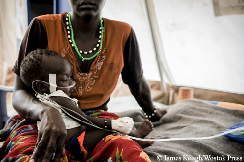 남수단 이다 난민캠프 내 위치한 국경없는의사회 진료소에서 치료받는 영양실조 아동