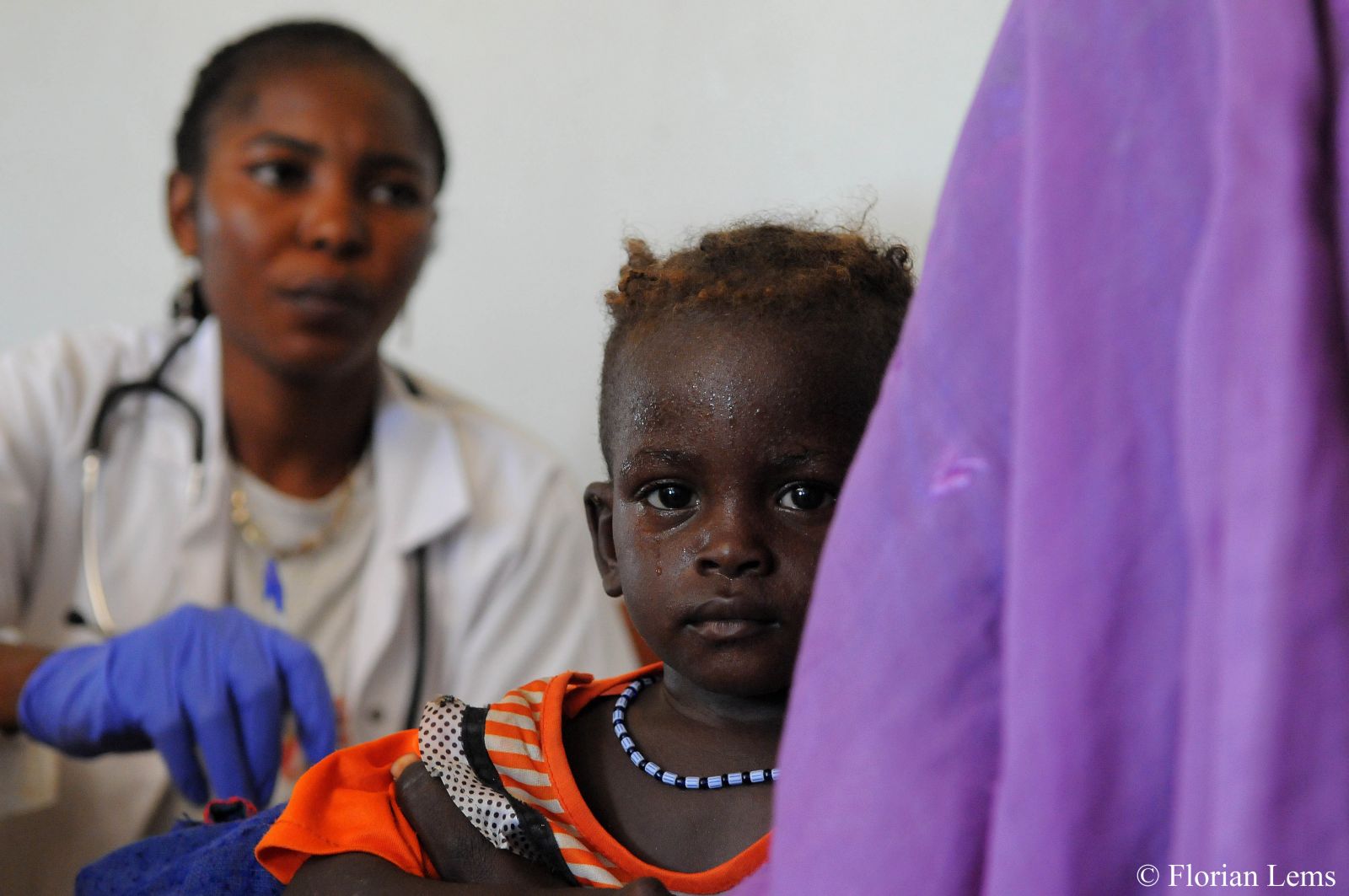 앙가라의 국경없는의사회 영양치료식 센터에서 어린이가 진찰 받고 있다.