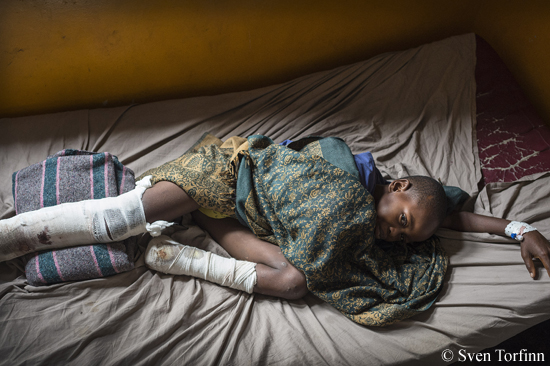 9살 소년 이든은 고마에 위치한 국경없는의사회 병원에서 회복 중에 있다.