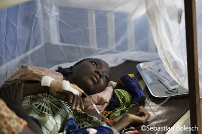소외질병인 수면병을 앓고 있는 여성 ©Sebastian Bolesch