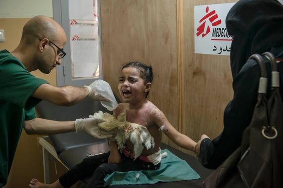 폭격으로 인해 가슴에 화상을 입은 4세 어린이 미나 ⓒYann Libessart/MSF