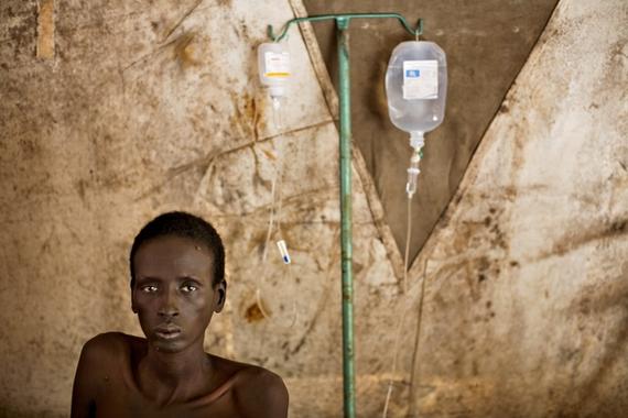 국경없는의사회가 남수단 나시르 주에 운영하고 있는 병원에서 HIV/AIDS 치료를 받는 누에르족 여성 ⓒFinbarr O'Reilly