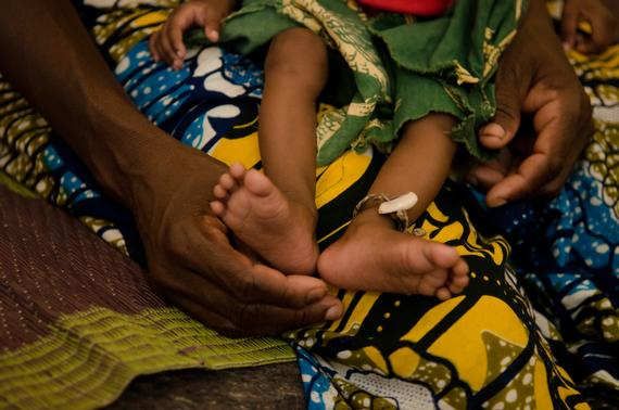 수개월을 걸어 카메룬에 피신한 중앙아프리카공화국 난민 가족. 안타깝게도 노인의 딸은 카메룬에서  출산 후 사망했고, 손자는 국경없는의사회 입원 치료식 센터에서 치료를 받게 됐다. ©Natacha Buhler/MSF