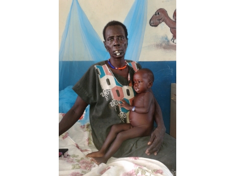 남수단: 피보르에서 점점 늘어나는 영양실조