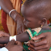 차드 쿨키메에서 국경없는의사회 이동 진료팀이 한 아동의 영양실조 검사를 하고 있다. ⓑMSF